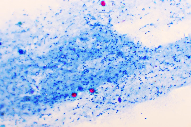 Cryptosporidium image