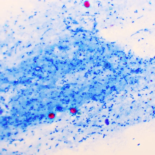 Cryptosporidium image